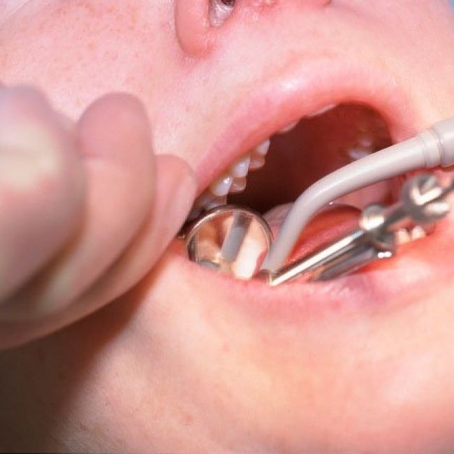 Periodoncias Periodoncias