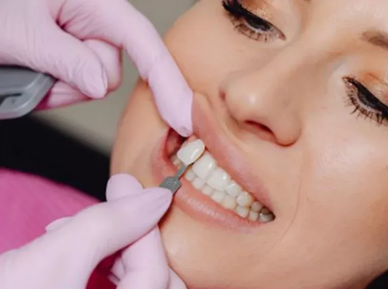 Tratamiento de blanqueamiento dental en clínica odontológica
