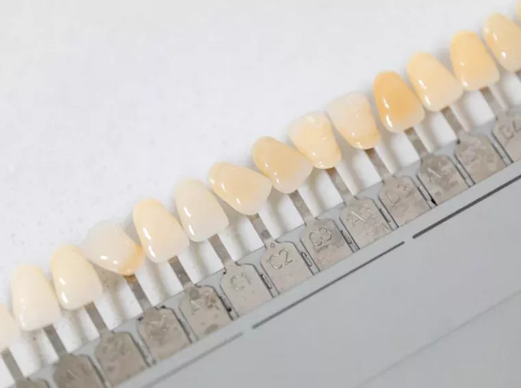 Restauraciones dentales y rehabilitaciones para mejorar la función oral
