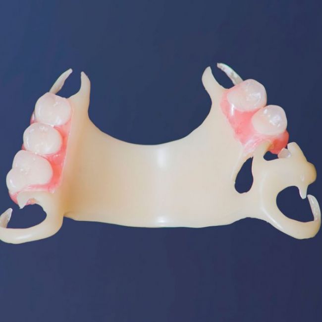 Prótesis dentales