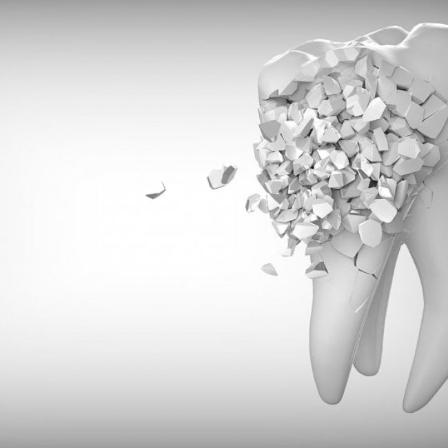 Restauraciones unitarias y rehabilitaciones